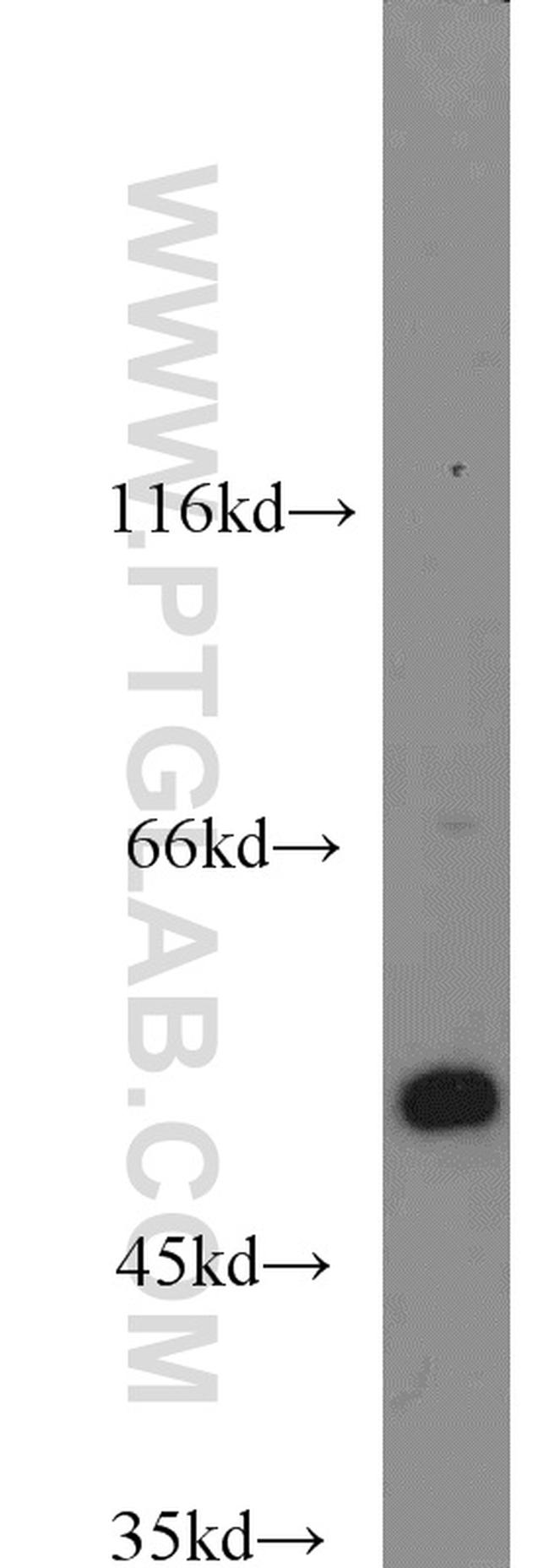 Beta Arrestin 2 Antibody in Western Blot (WB)