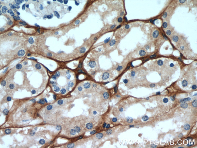 TGFBI / BIGH3 Antibody in Immunohistochemistry (Paraffin) (IHC (P))