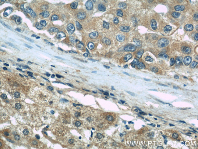 TGFBI / BIGH3 Antibody in Immunohistochemistry (Paraffin) (IHC (P))