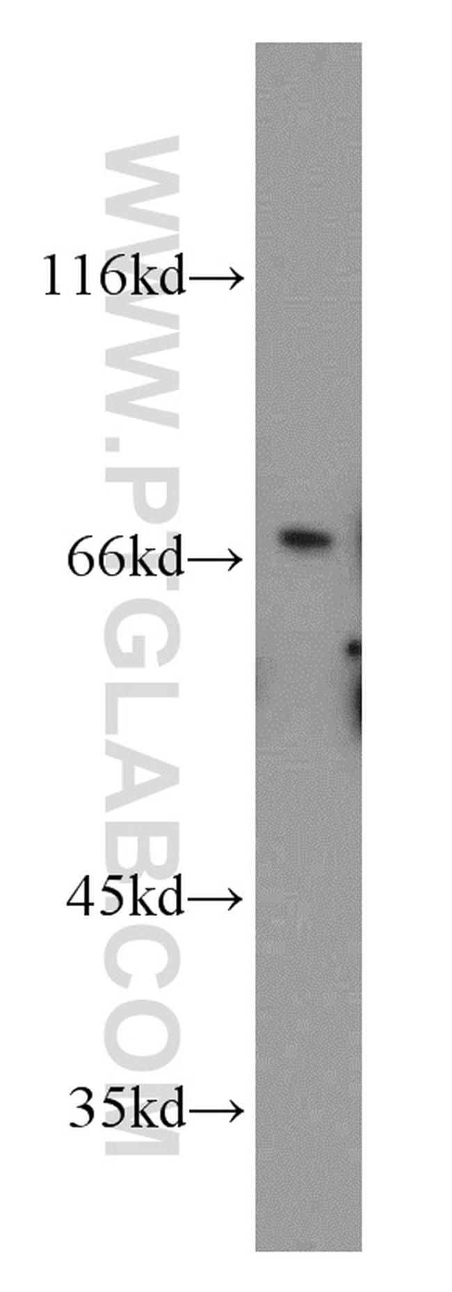 TGFBI / BIGH3 Antibody in Western Blot (WB)