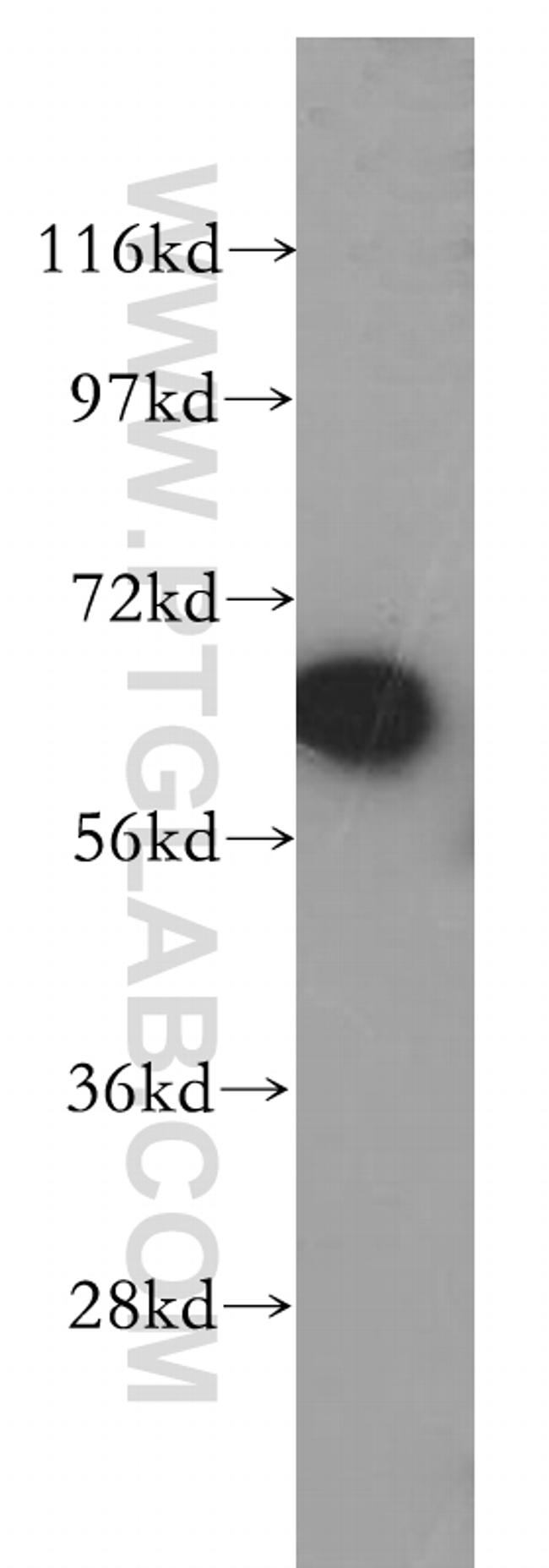 TGFBI / BIGH3 Antibody in Western Blot (WB)