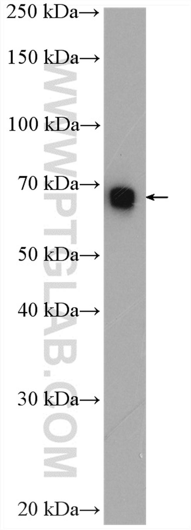 TGFBI / BIGH3 Antibody in Western Blot (WB)