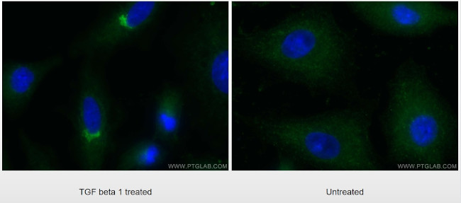 TGFBI / BIGH3 Antibody in Immunocytochemistry (ICC/IF)