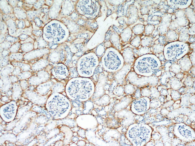 TGFBI / BIGH3 Antibody in Immunohistochemistry (Paraffin) (IHC (P))