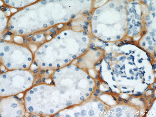 TGFBI / BIGH3 Antibody in Immunohistochemistry (Paraffin) (IHC (P))