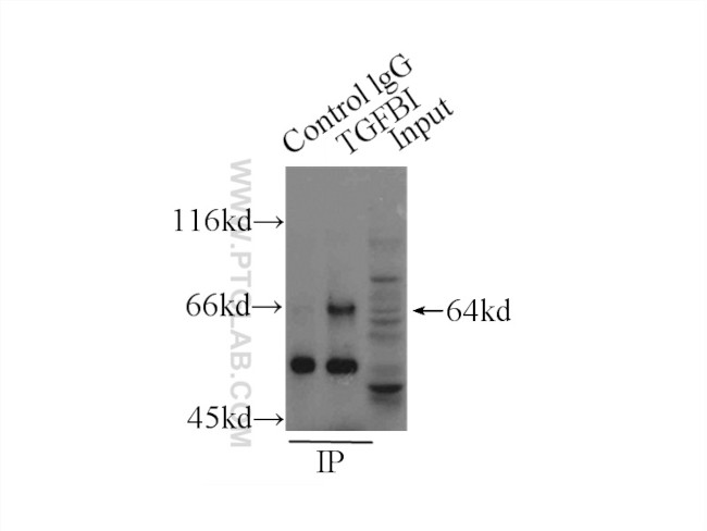 TGFBI / BIGH3 Antibody in Immunoprecipitation (IP)