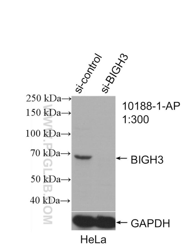 TGFBI / BIGH3 Antibody in Western Blot (WB)