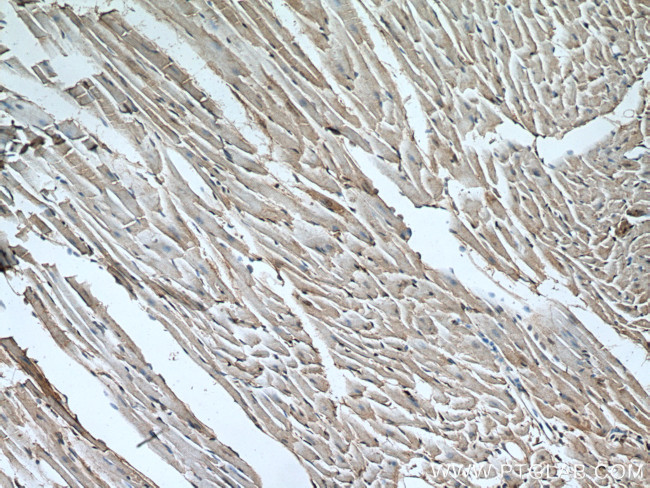 DFF45/DFFA Antibody in Immunohistochemistry (Paraffin) (IHC (P))