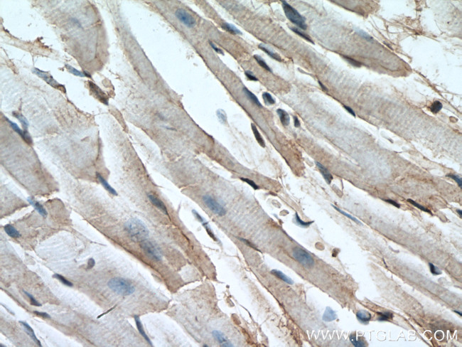 DFF45/DFFA Antibody in Immunohistochemistry (Paraffin) (IHC (P))