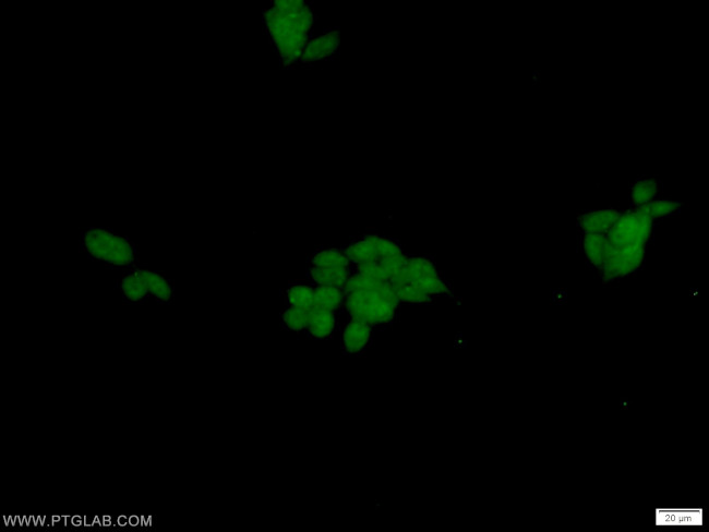 DFF45/DFFA Antibody in Immunocytochemistry (ICC/IF)