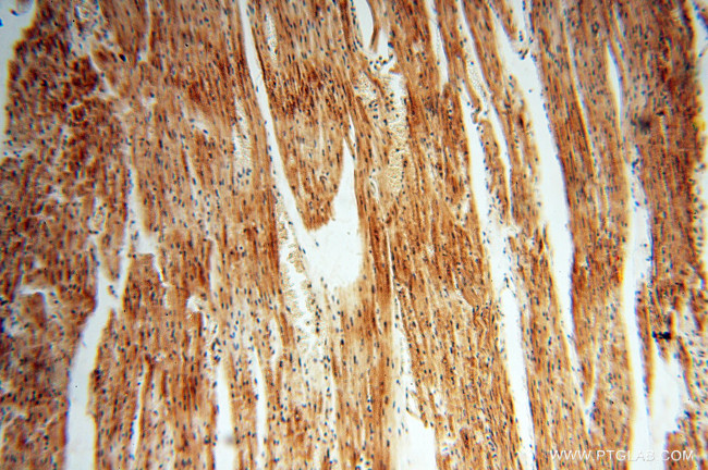 RUVBL2 Antibody in Immunohistochemistry (Paraffin) (IHC (P))