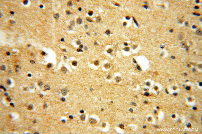 RUVBL2 Antibody in Immunohistochemistry (Paraffin) (IHC (P))