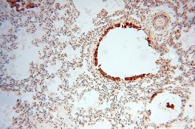 RUVBL2 Antibody in Immunohistochemistry (Paraffin) (IHC (P))