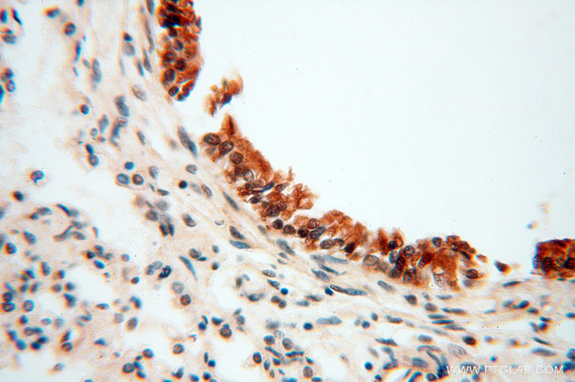 RUVBL2 Antibody in Immunohistochemistry (Paraffin) (IHC (P))