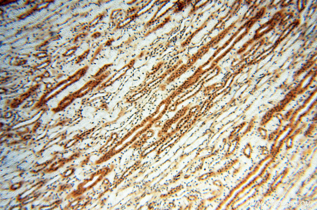 RUVBL2 Antibody in Immunohistochemistry (Paraffin) (IHC (P))