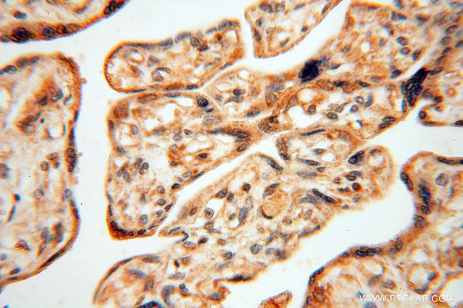 RUVBL2 Antibody in Immunohistochemistry (Paraffin) (IHC (P))