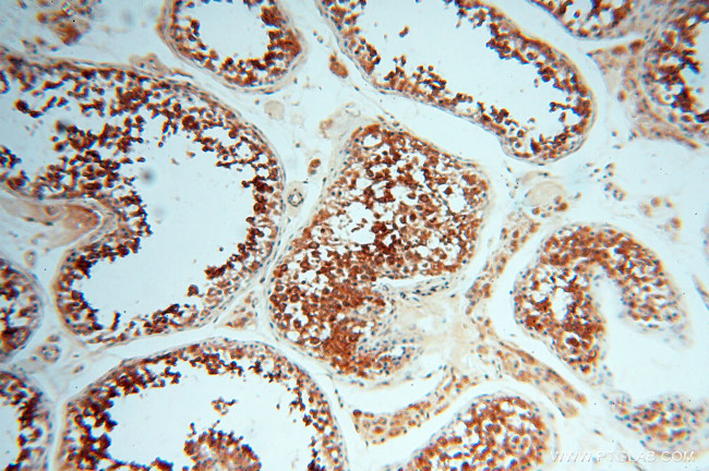 RUVBL2 Antibody in Immunohistochemistry (Paraffin) (IHC (P))