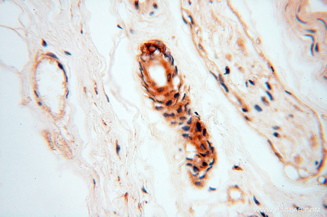 RUVBL2 Antibody in Immunohistochemistry (Paraffin) (IHC (P))