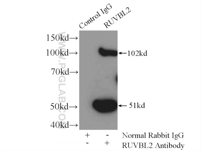 RUVBL2 Antibody in Immunoprecipitation (IP)