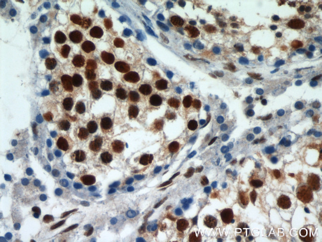 HDAC1 Antibody in Immunohistochemistry (Paraffin) (IHC (P))