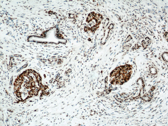 HDAC1 Antibody in Immunohistochemistry (Paraffin) (IHC (P))