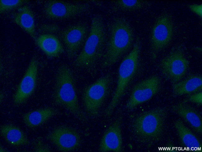 ARL4C Antibody in Immunocytochemistry (ICC/IF)