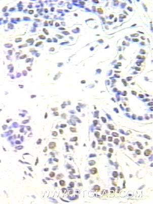 APEX1 Antibody in Immunohistochemistry (Paraffin) (IHC (P))