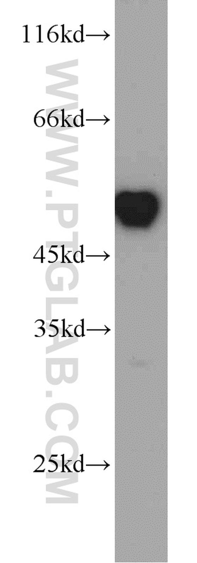 RUVBL1 Antibody in Western Blot (WB)