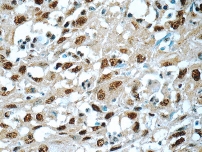 SNRPA Antibody in Immunohistochemistry (Paraffin) (IHC (P))