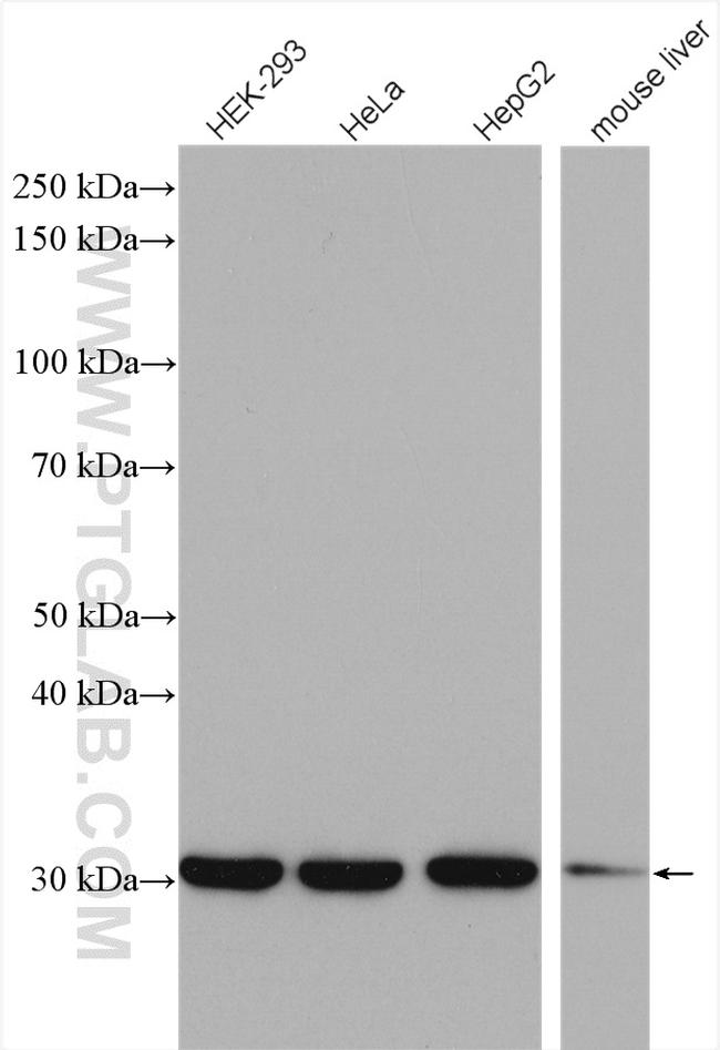 SNRPA Antibody in Western Blot (WB)