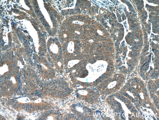 CDC37 Antibody in Immunohistochemistry (Paraffin) (IHC (P))