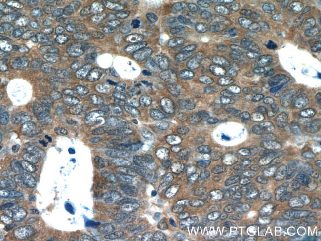 CDC37 Antibody in Immunohistochemistry (Paraffin) (IHC (P))