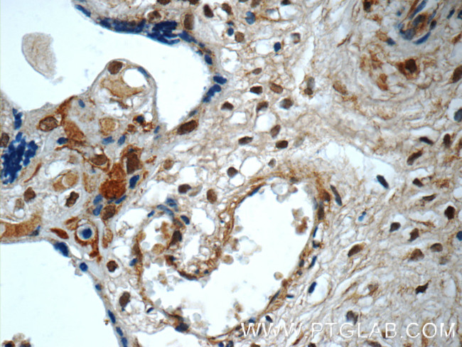 SMAD4 Antibody in Immunohistochemistry (Paraffin) (IHC (P))