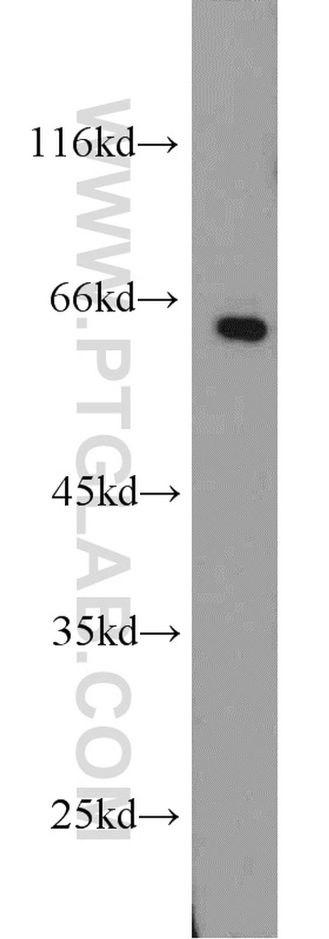 SMAD4 Antibody in Western Blot (WB)