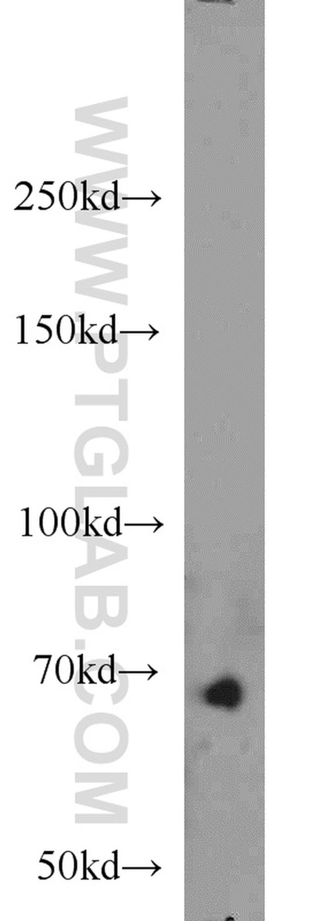 SMAD4 Antibody in Western Blot (WB)