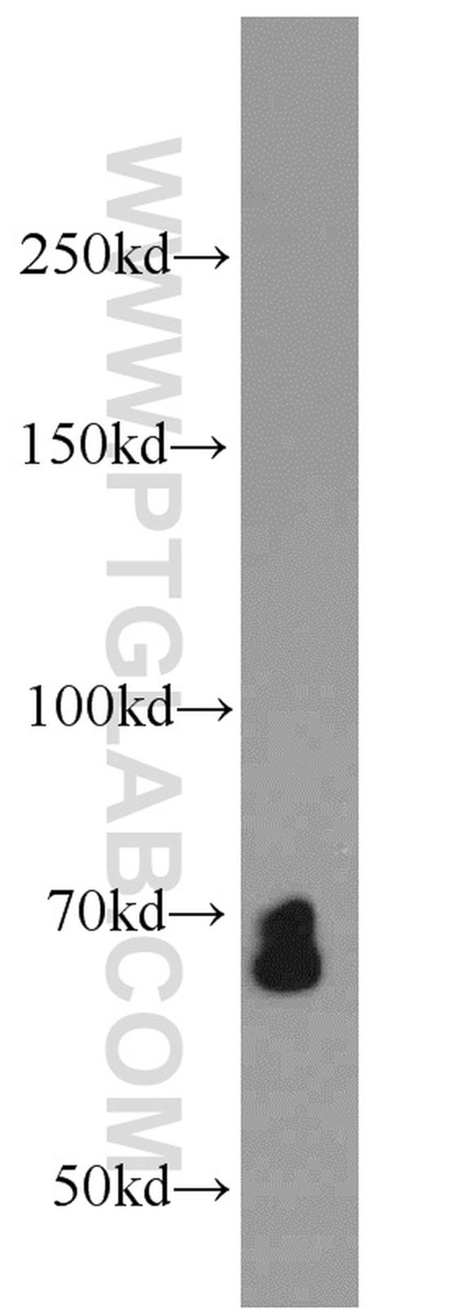 SMAD4 Antibody in Western Blot (WB)