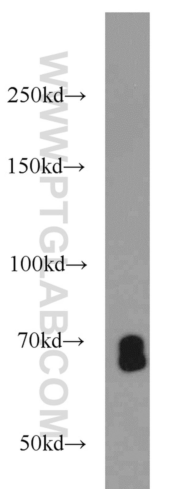 SMAD4 Antibody in Western Blot (WB)