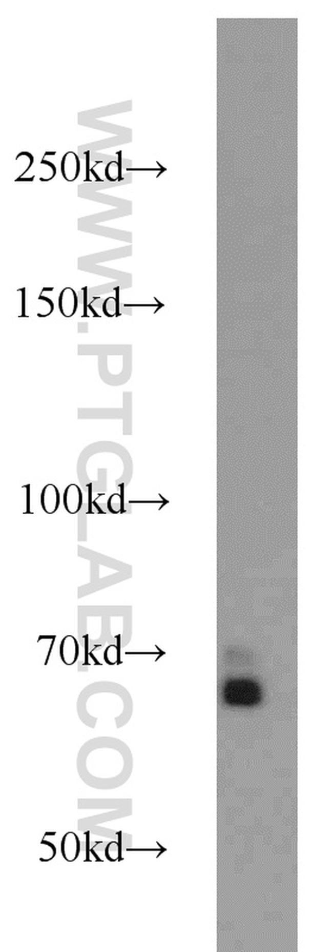 SMAD4 Antibody in Western Blot (WB)