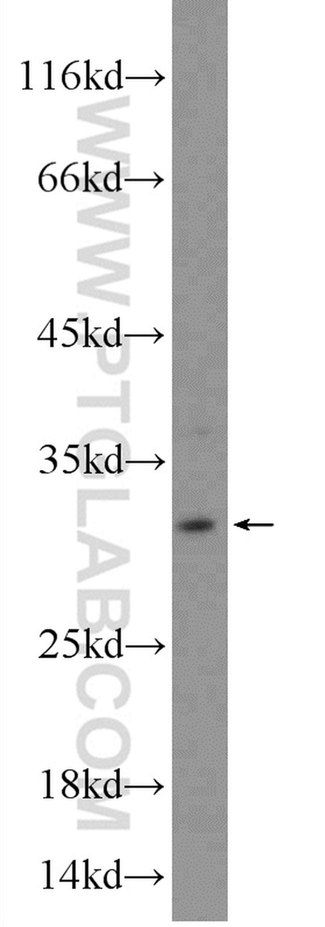 TIP30 Antibody in Western Blot (WB)