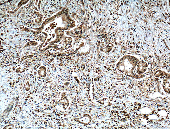 GRB2 Antibody in Immunohistochemistry (Paraffin) (IHC (P))