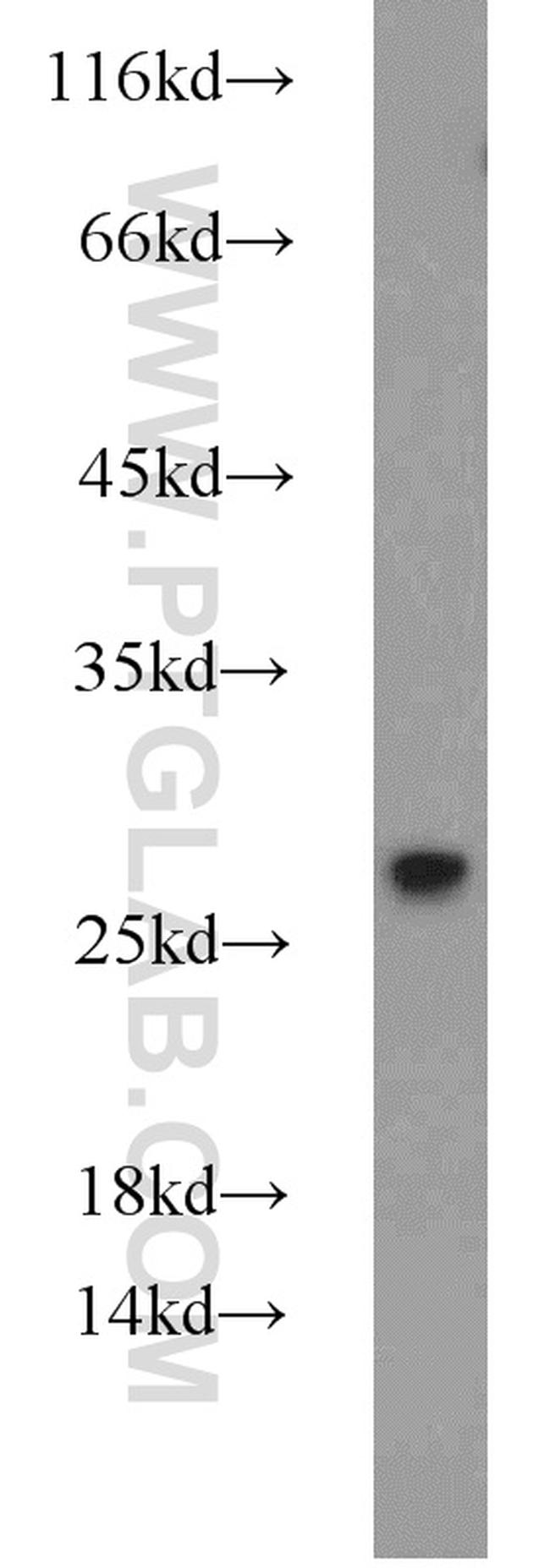 GRB2 Antibody in Western Blot (WB)