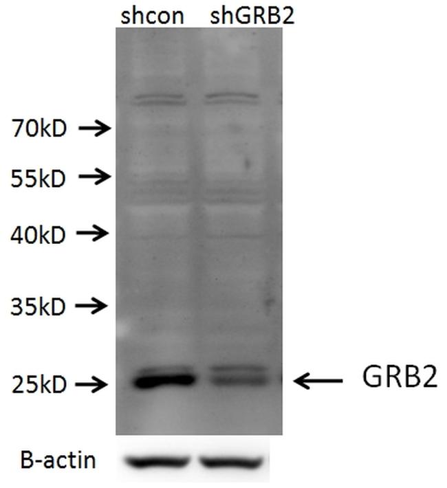 GRB2 Antibody in Western Blot (WB)