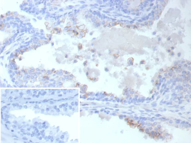 ABCC4/ATP Binding Cassette Subfamily C Member 4 (Drug Target) Antibody in Immunohistochemistry (Paraffin) (IHC (P))