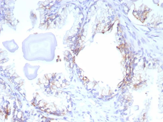 ABCC4/ATP Binding Cassette Subfamily C Member 4 (Drug Target) Antibody in Immunohistochemistry (Paraffin) (IHC (P))