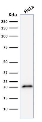 p21WAF1 (Tumor Suppressor Protein) Antibody in Western Blot (WB)