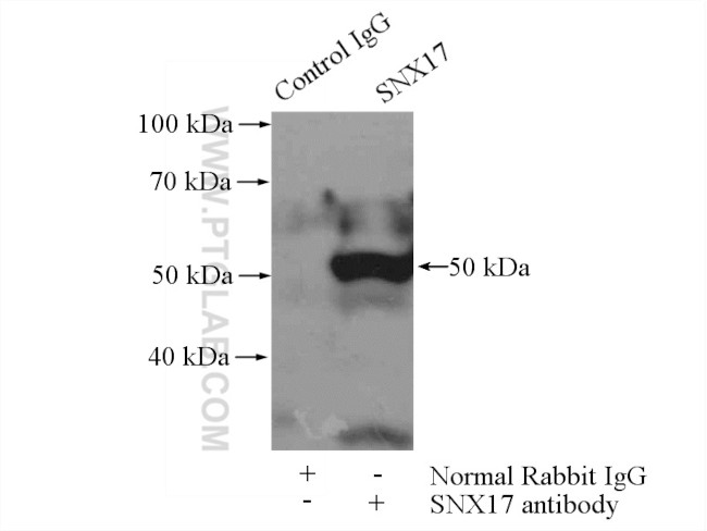 SNX17 Antibody in Immunoprecipitation (IP)