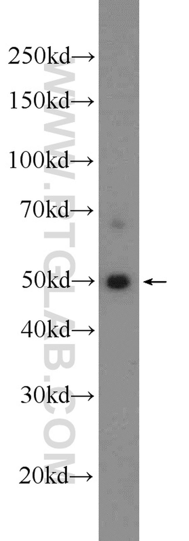 SNX17 Antibody in Western Blot (WB)
