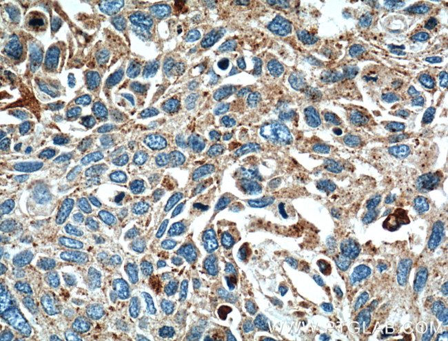 LGALS3BP Antibody in Immunohistochemistry (Paraffin) (IHC (P))