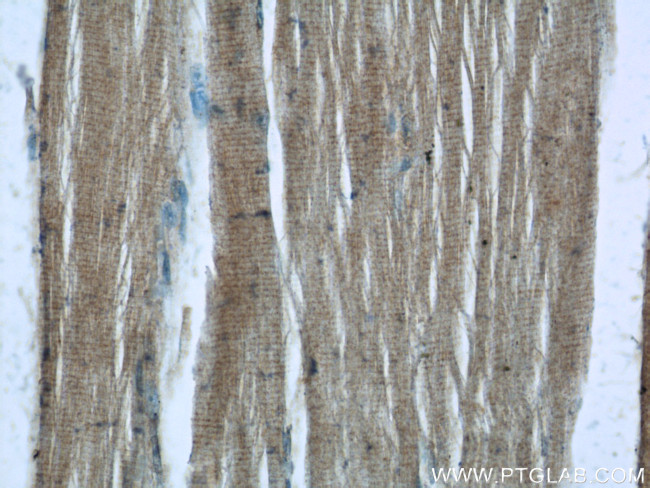 AMPK gamma 1 Antibody in Immunohistochemistry (Paraffin) (IHC (P))