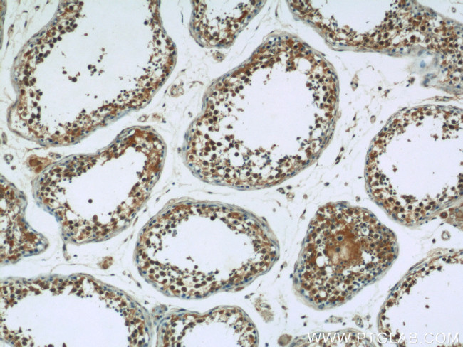 AMPK gamma 1 Antibody in Immunohistochemistry (Paraffin) (IHC (P))